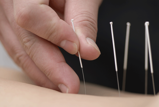 Akupunktur Zararları
